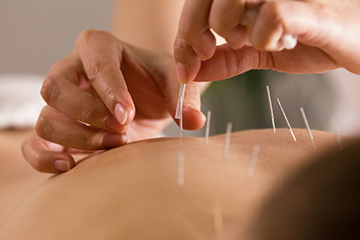 Chiropractic Treatment Image